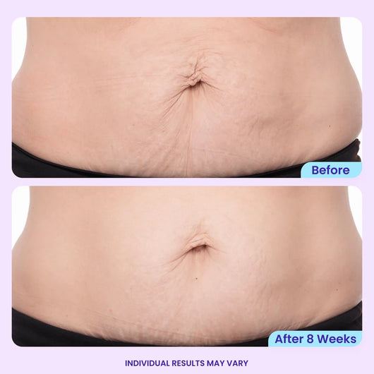 GOLUNE Moonlift Belly Cream